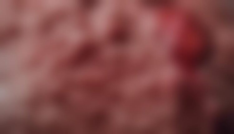 diagnosing canine skin lesions